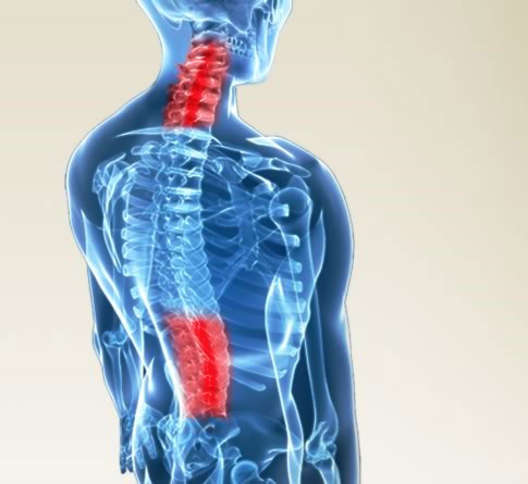 Thoái hóa đốt sống cổ, đốt sống lưng là bệnh thường gặp không chỉ ở người cao tuổi