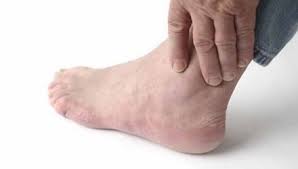 Nguyên nhân gây ra bệnh Gout