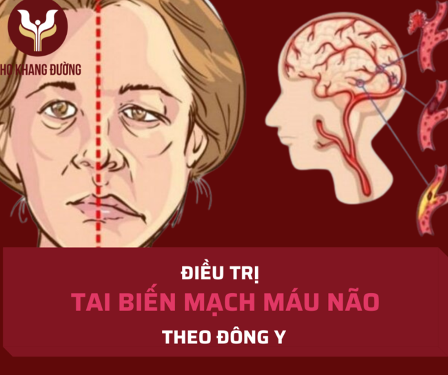 Các bài thuốc điều trị tai biến mạch máu não hiệu quả
